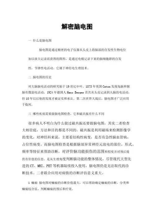 解密脑电图