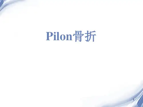 Pilon骨折PPT课件