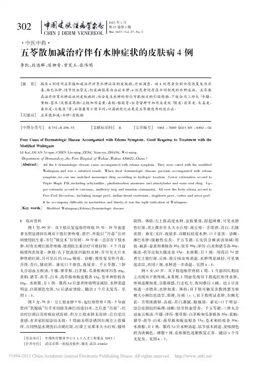 五苓散加减治疗伴有水肿症状的皮肤病4例