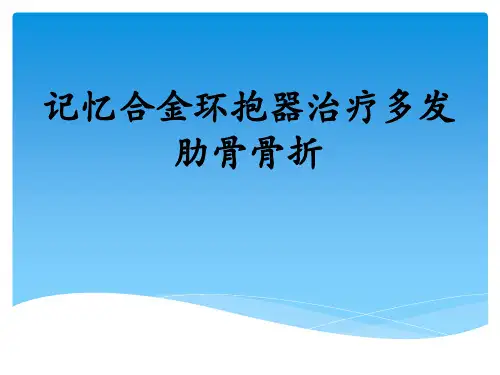肋骨骨折内固定术