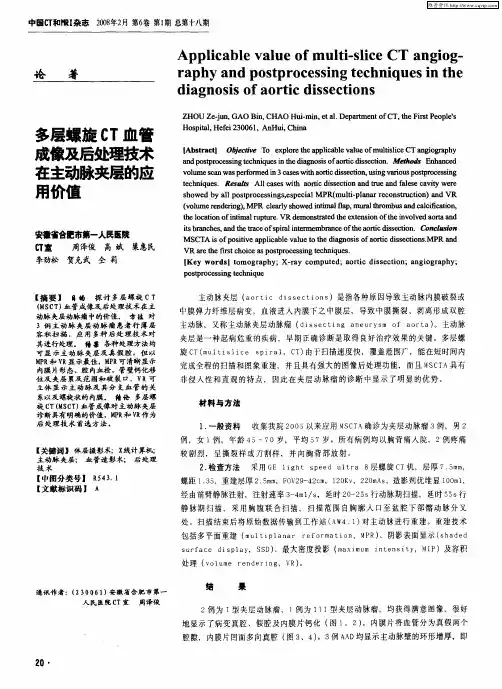 多层螺旋CT血管成像及后处理技术在主动脉夹层的应用价值