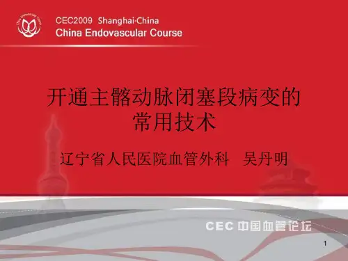开通主髂动脉闭塞段病变的常用技术吴丹明PPT课件