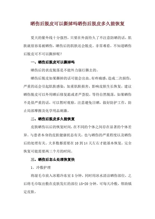 晒伤后脱皮可以撕掉吗 晒伤后脱皮多久能恢复