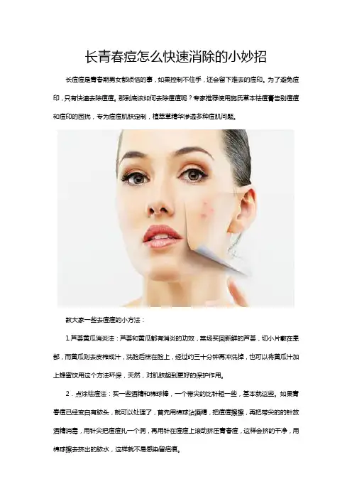 长青春痘怎么快速消除的小妙招
