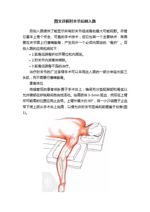 图文详解肘关节后侧入路