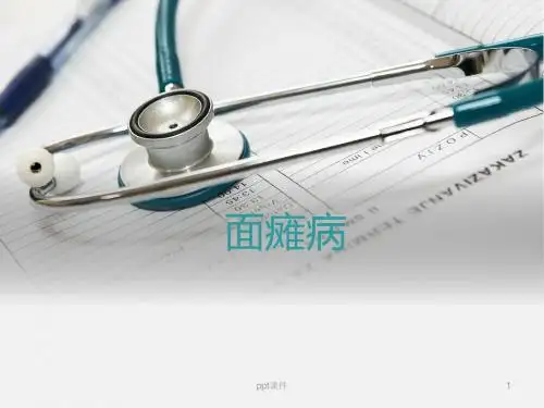 面瘫病  ppt课件