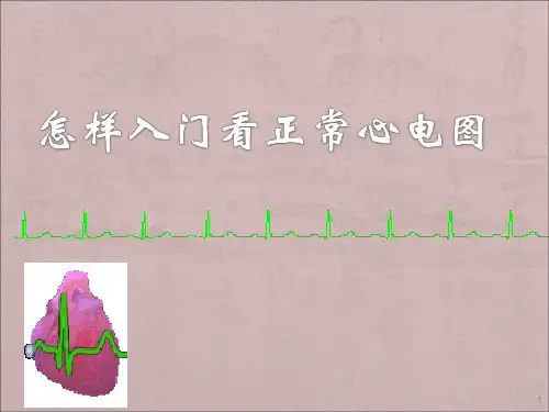 如何入门看正常心电图ppt课件