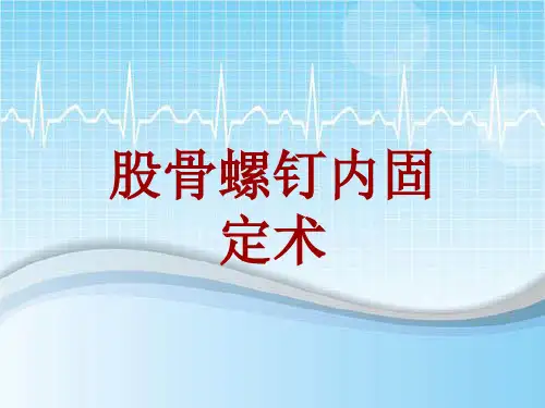 手术讲解模板：股骨螺钉内固定术