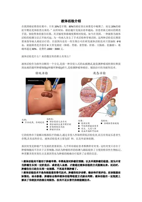 癌症检测新方向液体活检