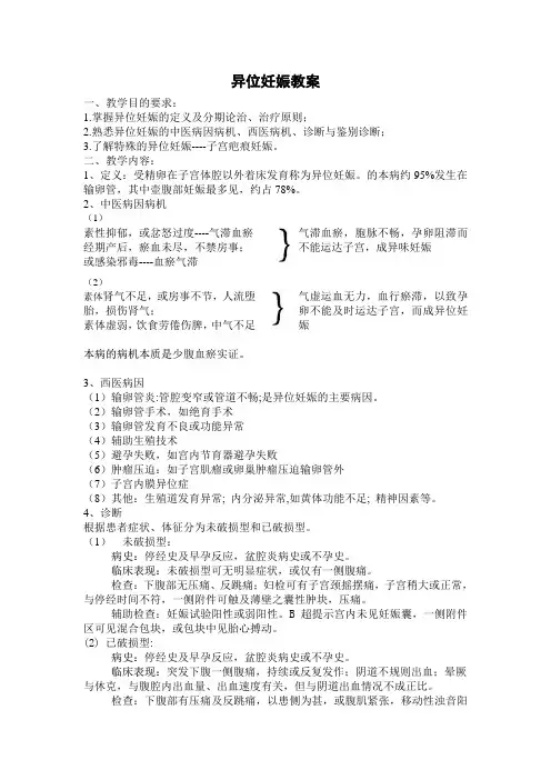 异位妊娠教案 