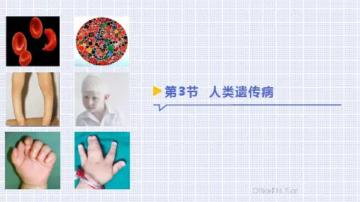 【高中生物】人类遗传病课件 2022-2023学年高一下学期生物人教版必修2