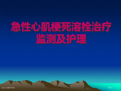 急性心肌梗死溶栓