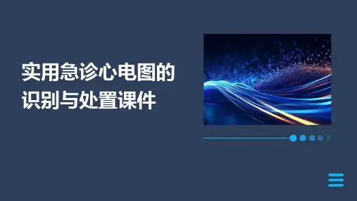 实用急诊心电图的识别与处置课件