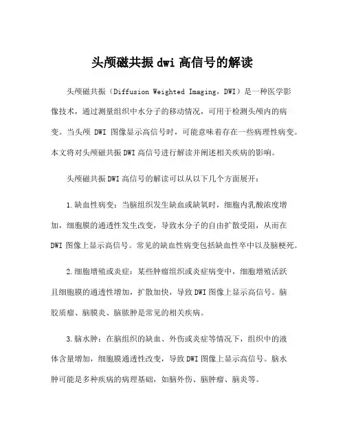 头颅磁共振dwi高信号的解读
