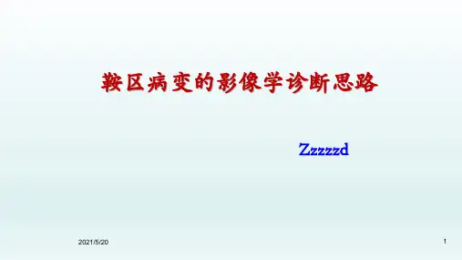 鞍区病变的影像学诊断思路