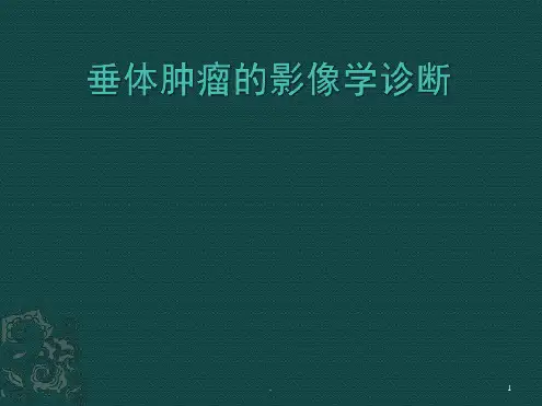 垂体病变的影像学诊断ppt课件