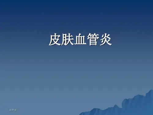 皮肤血管炎