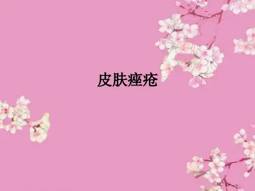 皮肤痤疮ppt课件