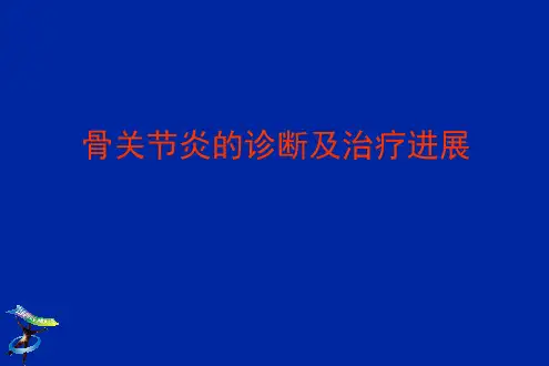 骨关节炎的诊治进展PPT课件