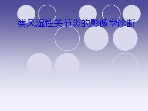 类风湿性关节炎的影像学诊断