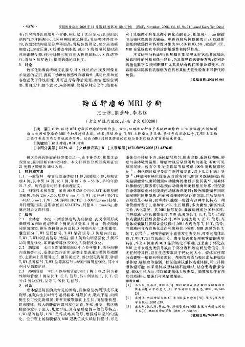 鞍区肿瘤的MRI诊断