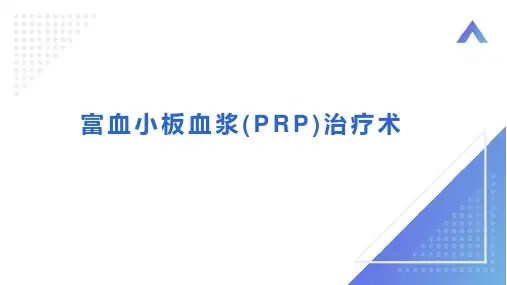 富血小板血浆治疗术