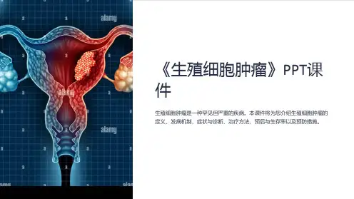 《生殖细胞肿瘤》课件
