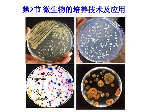 微生物的培养技术及应用课件(共37张PPT)人教版选择性必修3