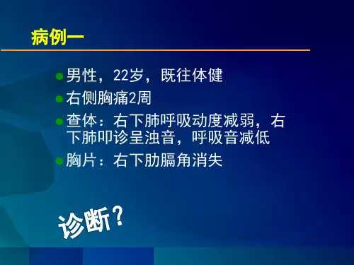 胸腔积液—医学生学习课件