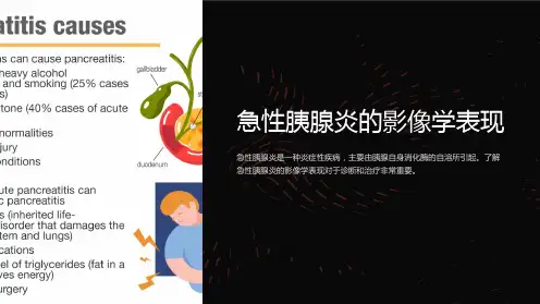 急性胰腺炎的影像学表现
