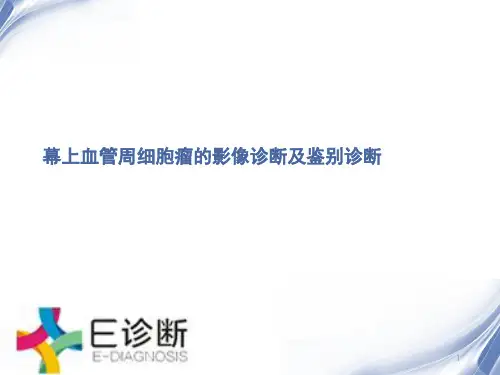 医学影像幕上血管周细胞瘤的影像诊断及鉴别诊断PPT课件