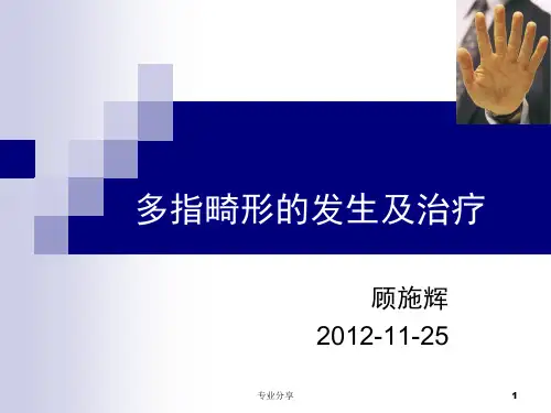 多指畸形的发生及治疗(行业精制)