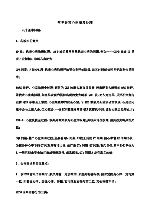 常见异常心电图及处理