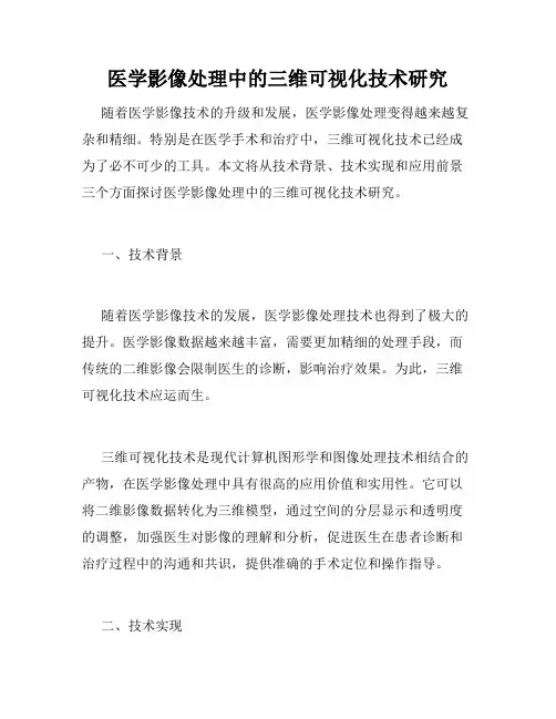 医学影像处理中的三维可视化技术研究
