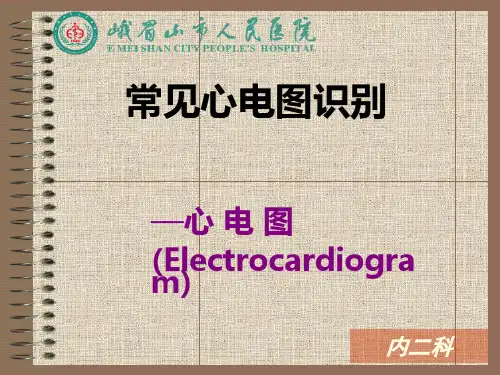 常见心电图识别
