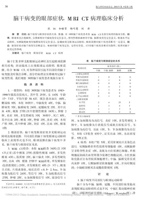脑干病变的眼部症状_MRI_CT_病理临床分析_耿虹