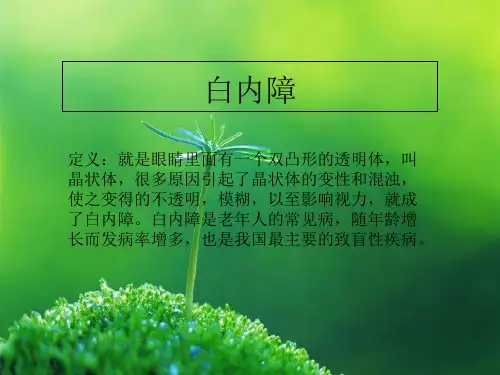 年龄相关性白内障