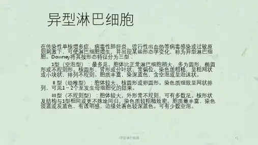 异型淋巴细胞课件
