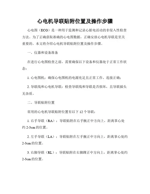 心电机导联贴附位置及操作步骤