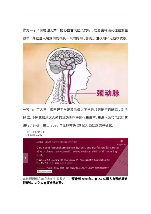 科学发现：全球近20亿人颈动脉粥样硬化