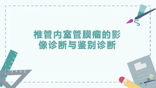 椎管内室管膜瘤的影像诊断与鉴别诊断