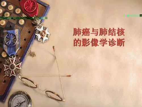 肺癌与肺结核的影像学诊断