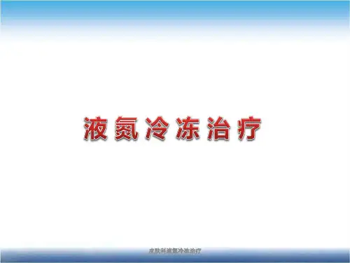 皮肤科液氮冷冻治疗