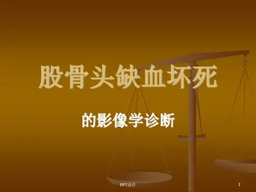 股骨头坏死的影像学诊断  ppt课件