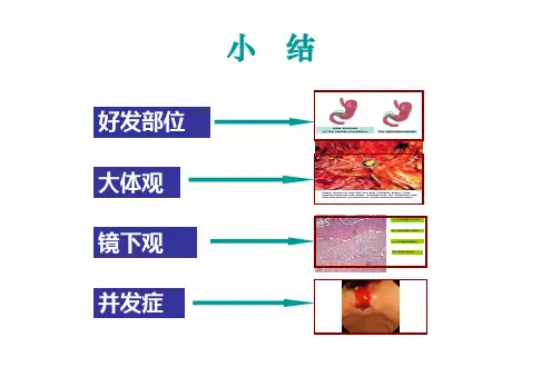 病毒性肝炎
