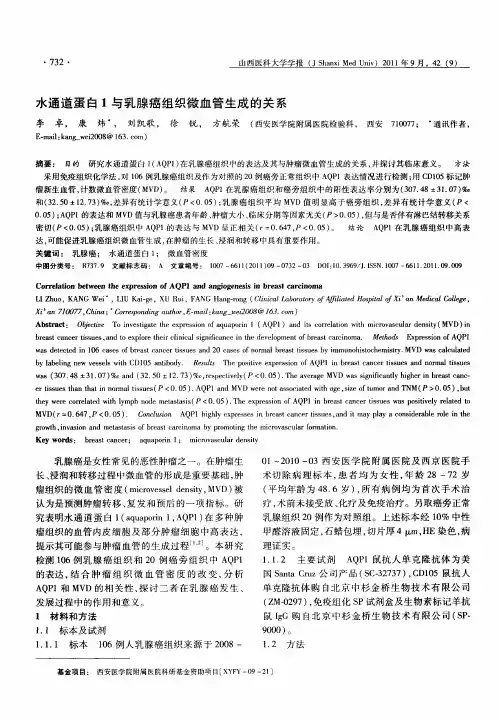 水通道蛋白1与乳腺癌组织微血管生成的关系