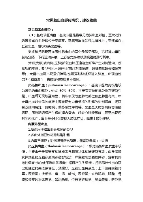 常见脑出血部位辨识，建议收藏