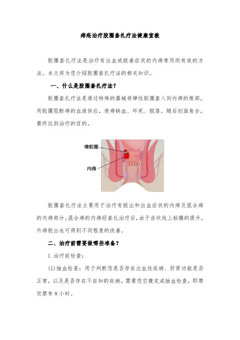 痔疮治疗胶圈套扎疗法健康宣教