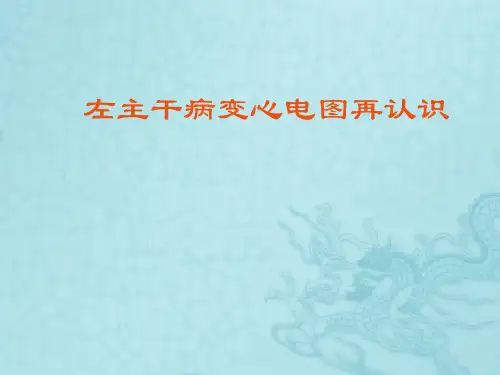 左主干病变心电图再认识