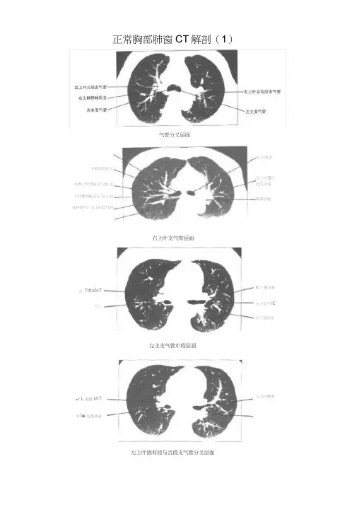 正常胸部CT解剖(肺窗和纵隔窗)